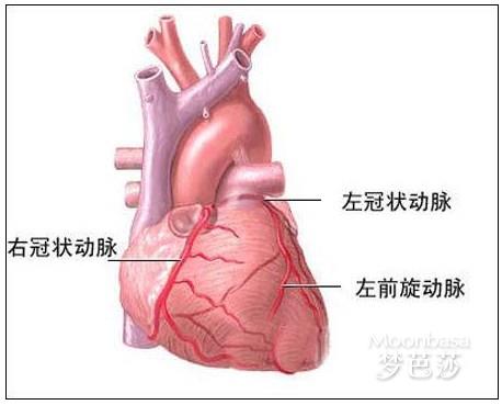 心肌梗塞治疗费用