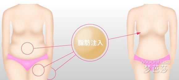 怎样丰胸最快最有效