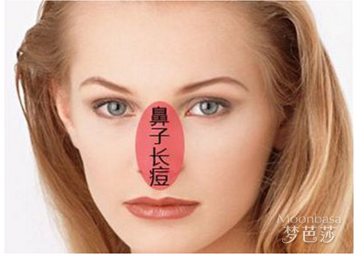 鼻翼长痘痘